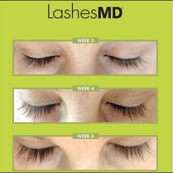 Lashes MD - Picture 6 of 6